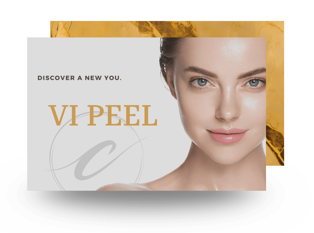 Professional VI Peel facial rejuvenation to improve skin tone and texture at Cloud Nine Aesthetics Jacksonville IL.