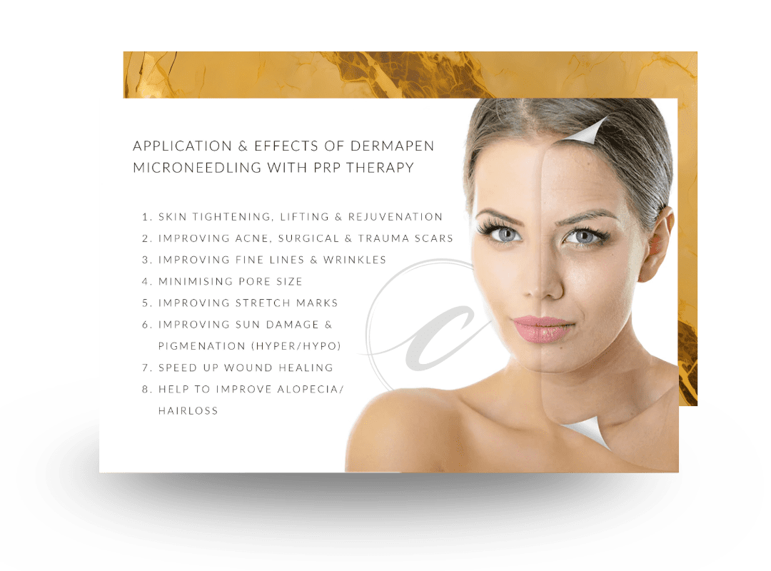 Microneedling with PRP facial treatment to boost collagen and skin rejuvenation at Cloud Nine Aesthetics in Jacksonville IL.
