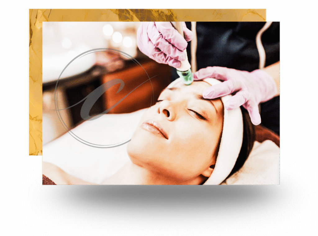 Advanced microneedling procedure to improve texture and tone at Cloud Nine Aesthetics Jacksonville IL.