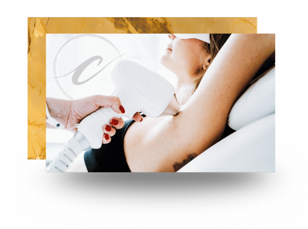 Advanced laser hair removal procedure for long lasting results at Cloud Nine Aesthetics Jacksonville IL.